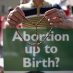 Over 100,000 sign petition calling for reduction to abortion time limit