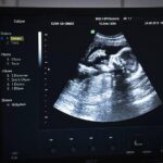 Gay couple seek partial refund if surrogate has a girl